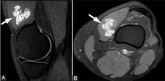 Figure 19(A, B)