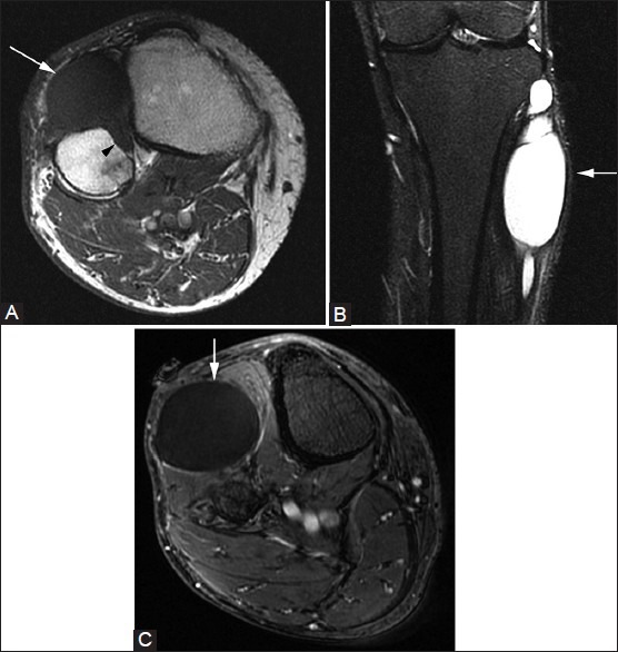 Figure 2(A-C)