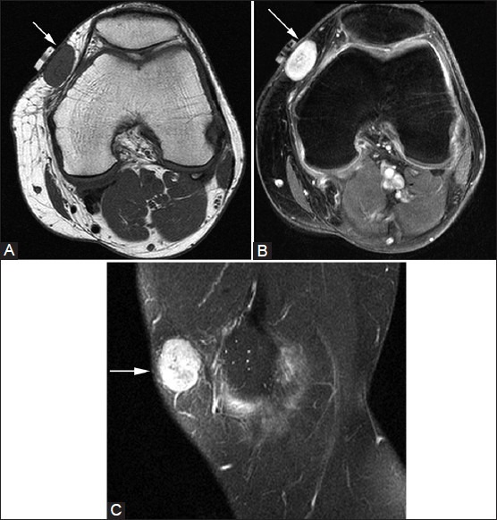 Figure 25(A-C)