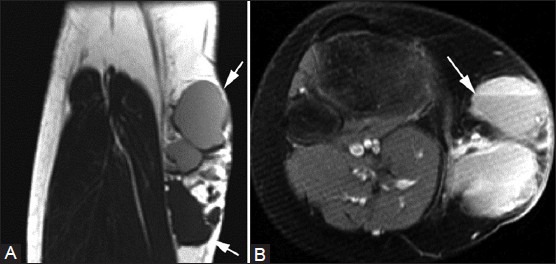 Figure 20(A, B)