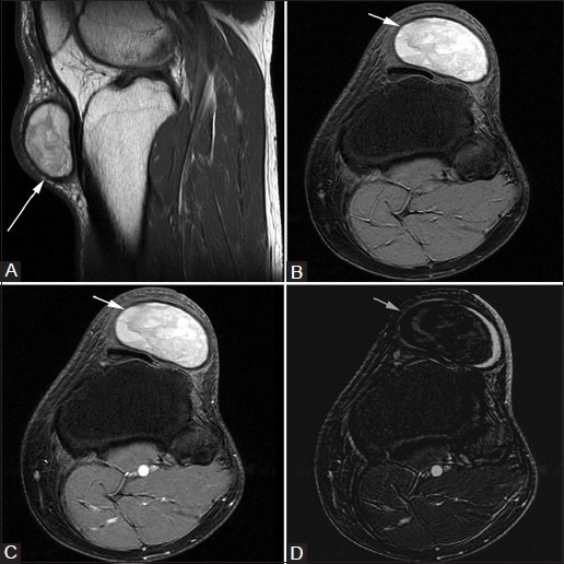 Figure 15(A-D)