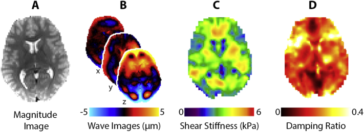 Fig. 1