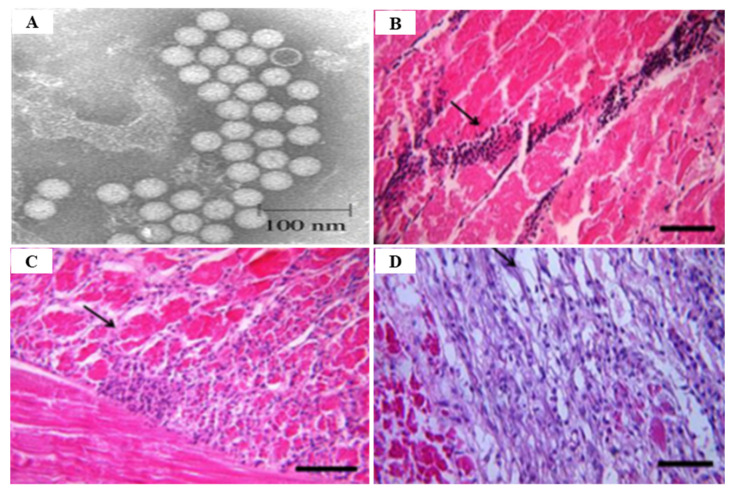 Figure 14