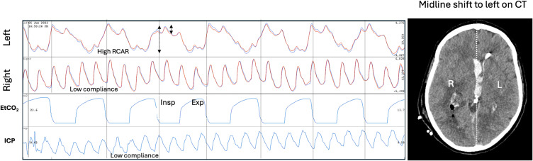 Figure 15