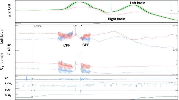 Figure 16