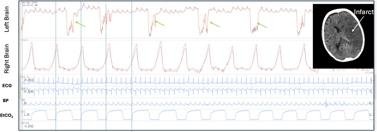 Figure 14