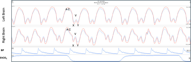 Figure 12