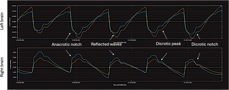 Figure 13