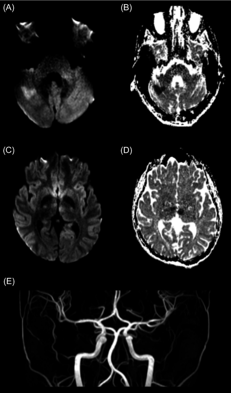 Figure 1: