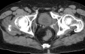 Figure 10.