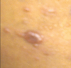 Figure 2a