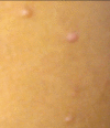 Figure 2b