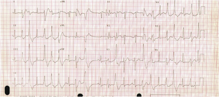 Fig. 1