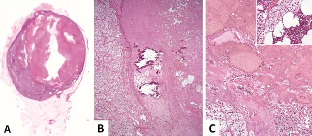 Fig. 17