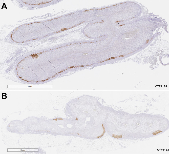 Fig. 15