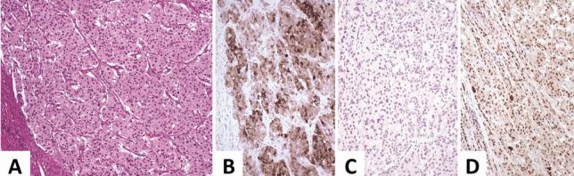 Fig. 18