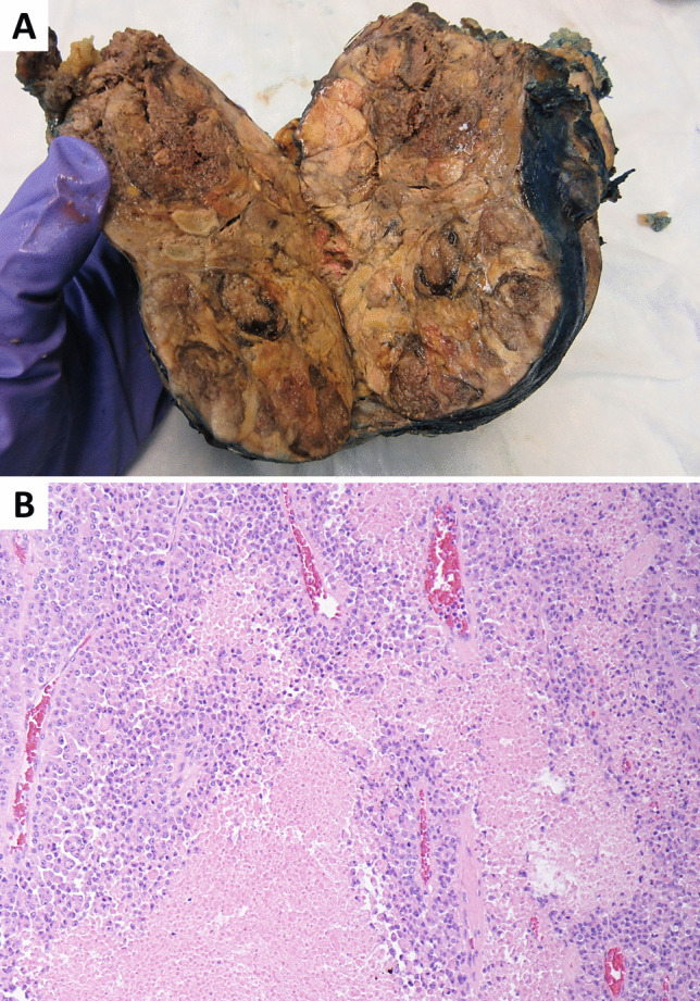 Fig. 23