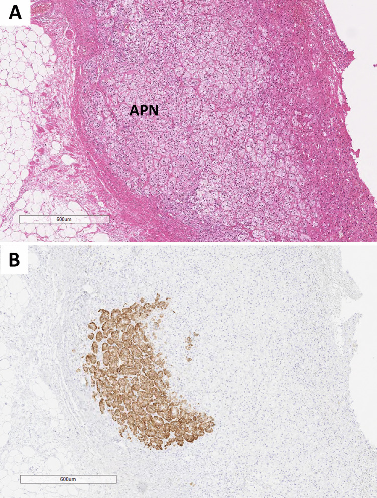 Fig. 14