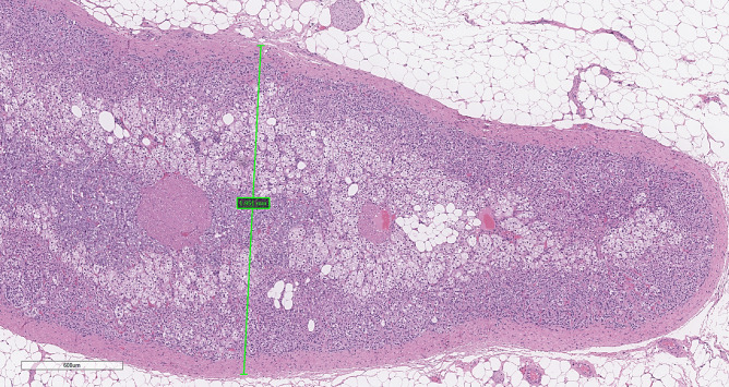 Fig. 16