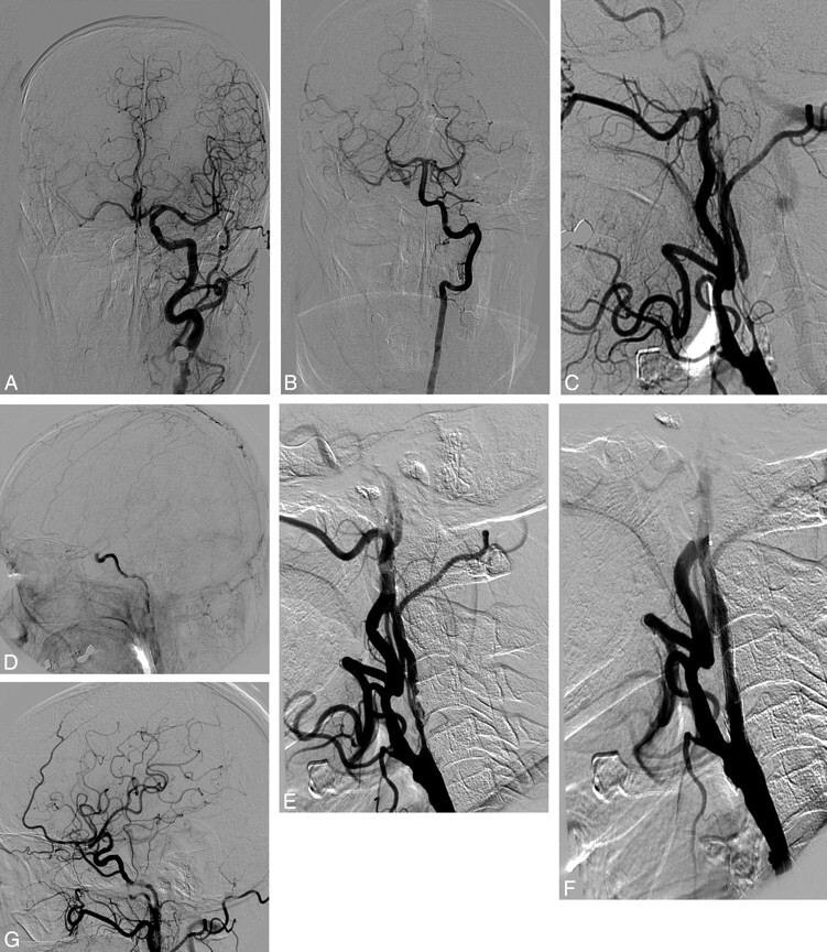 Fig 3.