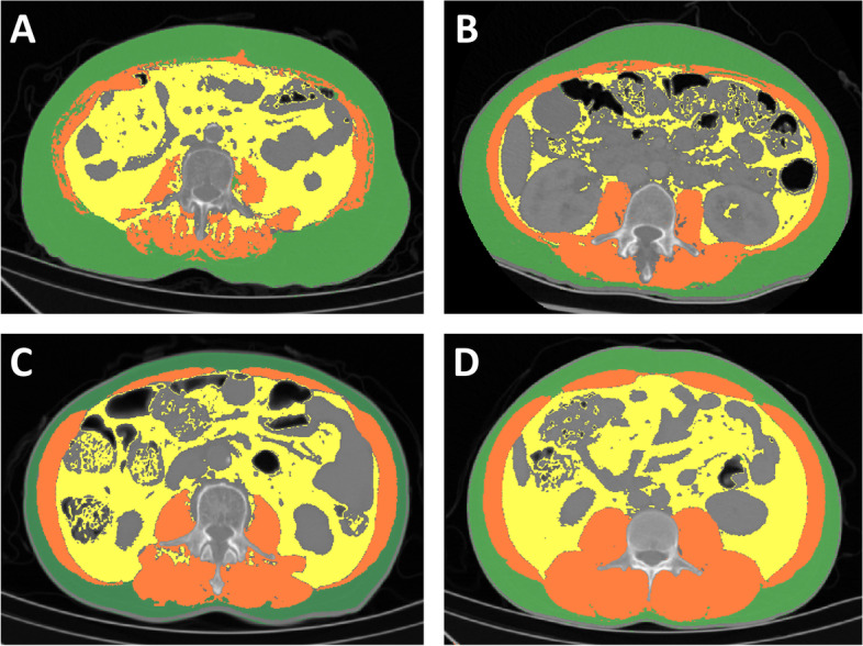 Fig. 2