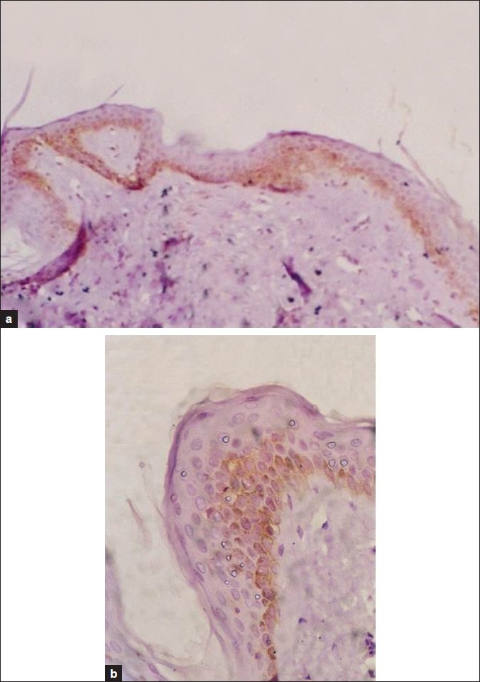 Figure 5a, b