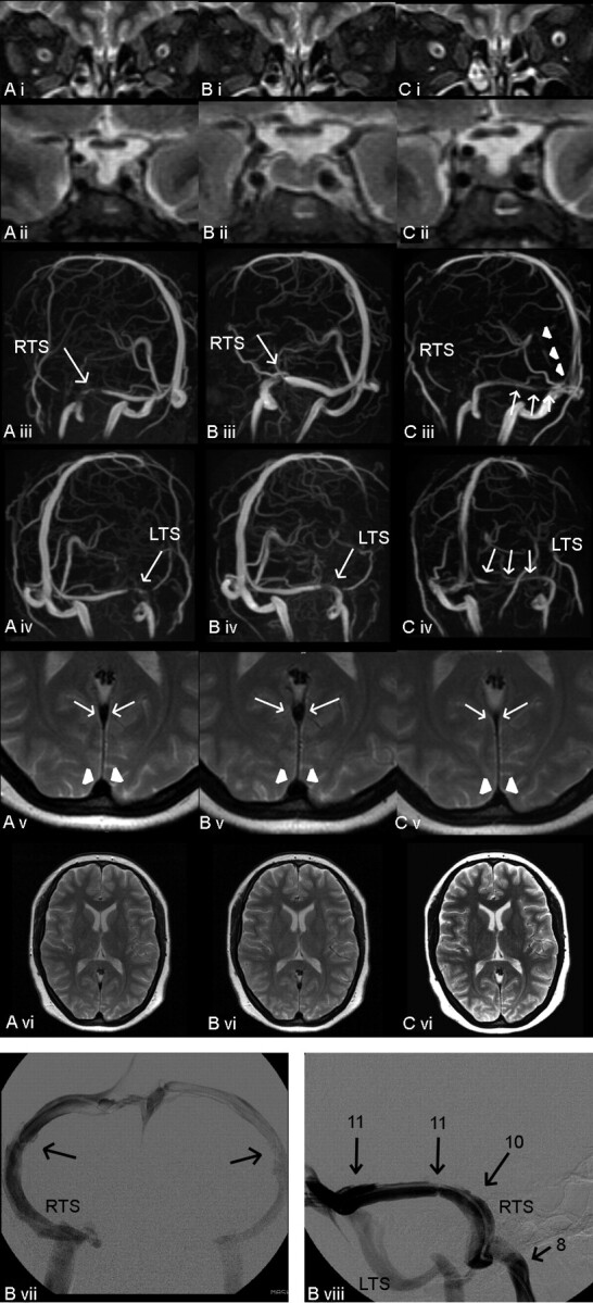 Fig 3.