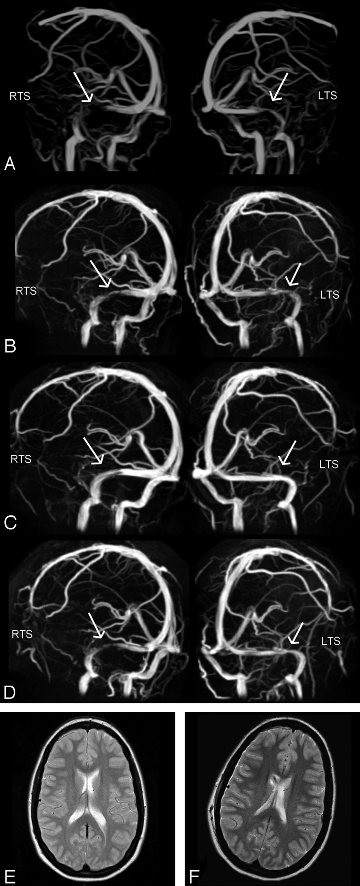 Fig 2.