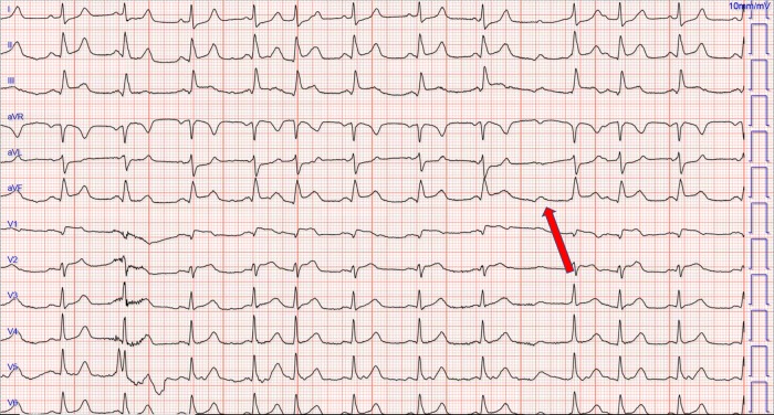 Figure 1: