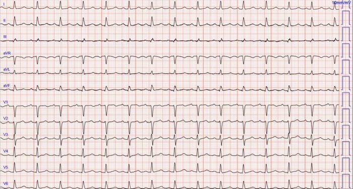 Figure 2: