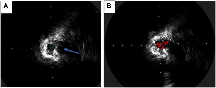 Figure 2