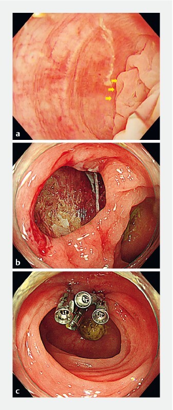 Fig. 1