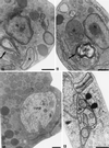 FIG. 10–13.