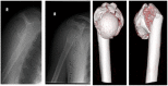 Fig. 4a