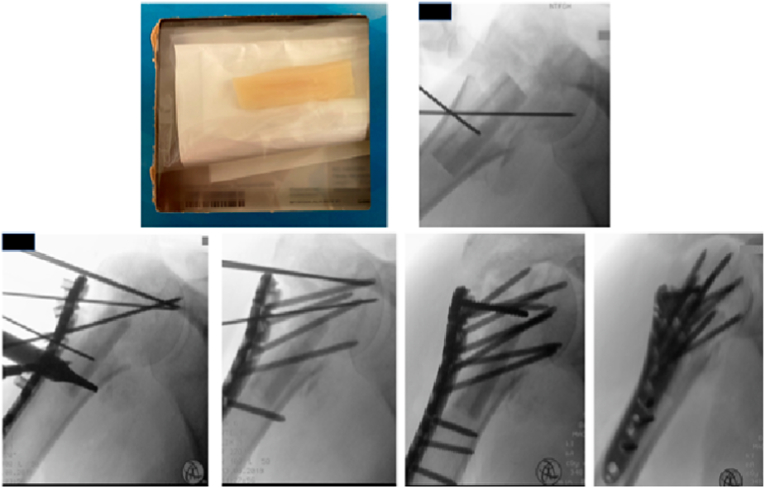 Fig. 4b