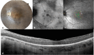 Fig. 3
