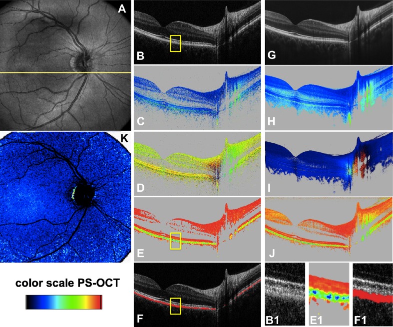 Fig. 2