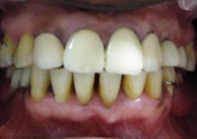 Fig. 7
