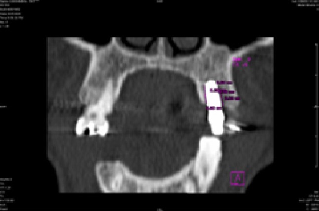 Fig. 8