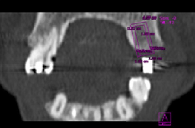 Fig. 2