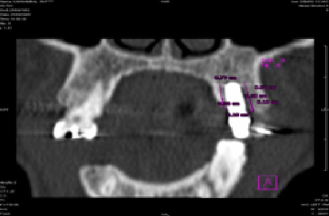 Fig. 9