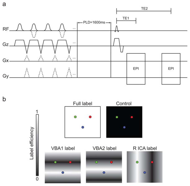 FIG. 1