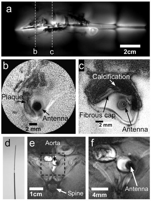 FIG. 5