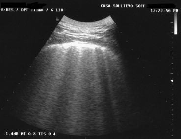 Fig. 13