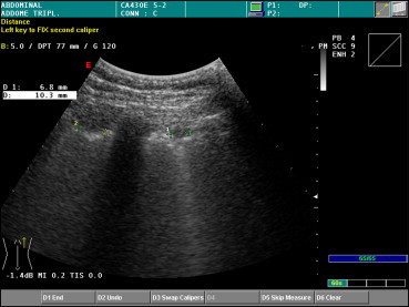 Fig. 11
