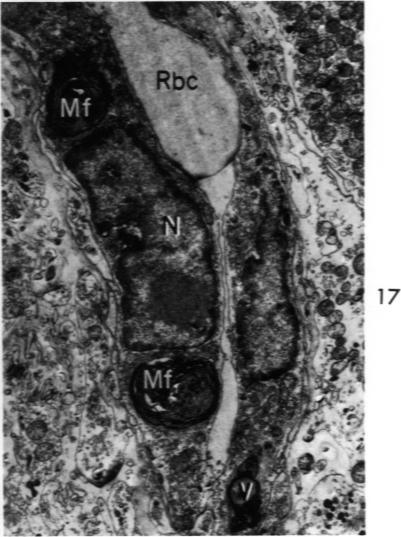 Fig 17