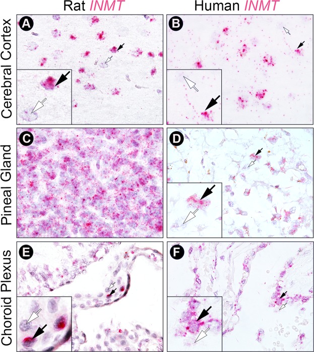 Biosynthesis and Extracellular Concentrations of N,N-dimethyltryptamine ...