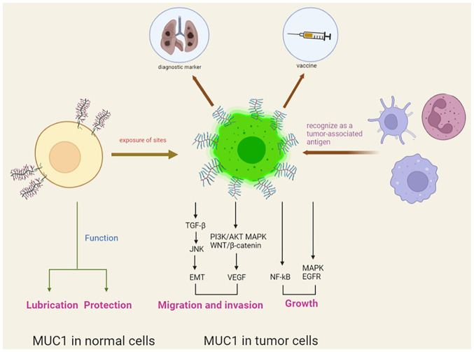 Expression of MUC1 in different tumours and its clinical significance ...