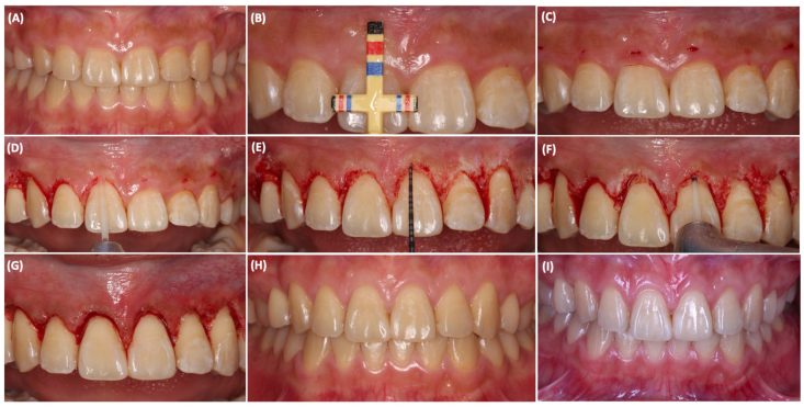 Figure 1