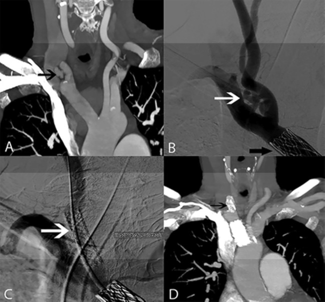 Figure 2